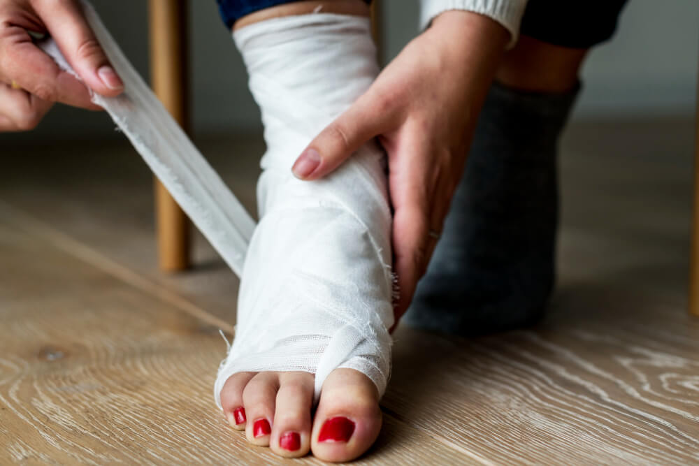 Fractures Understanding Your Legal Rights