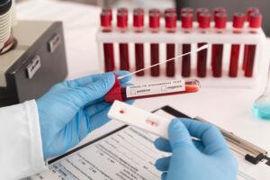 Laboratory Services for Blood Testing