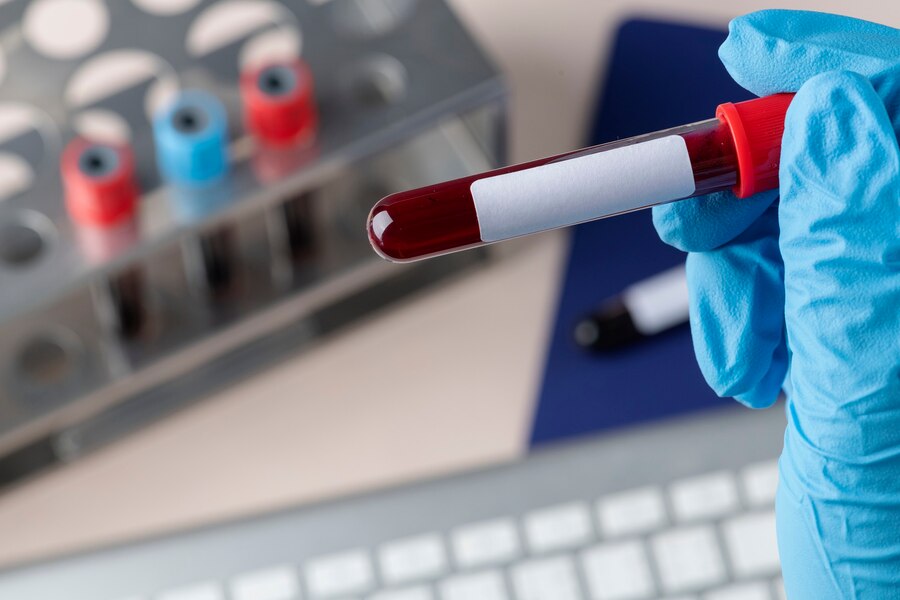 Laboratory Services for Blood Testing