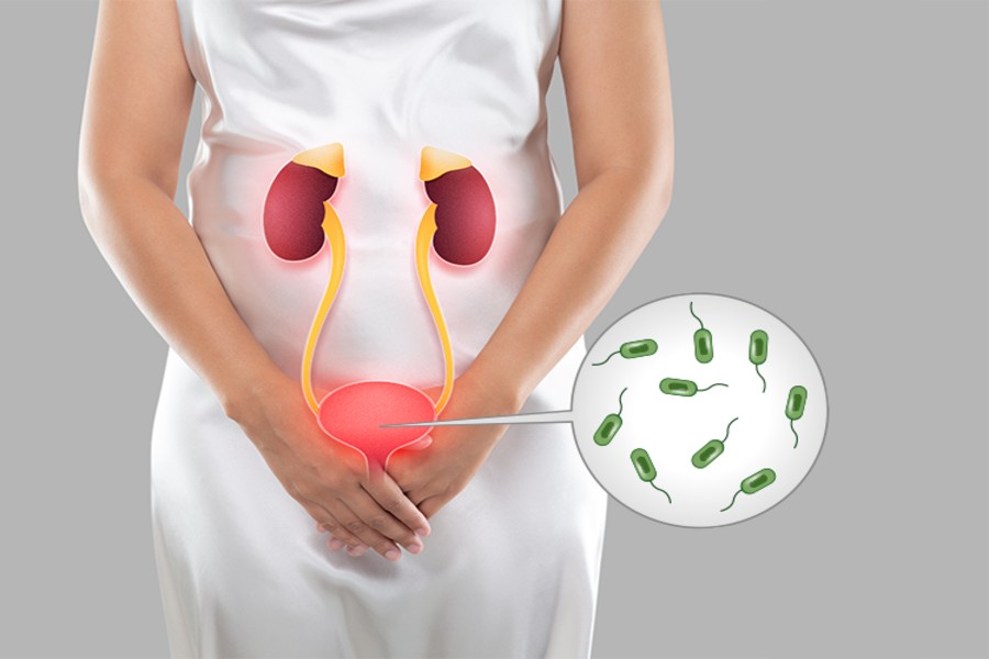 Urinary Tract Infection Treatment