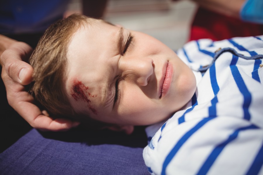 Minor Head Injuries After a Crash