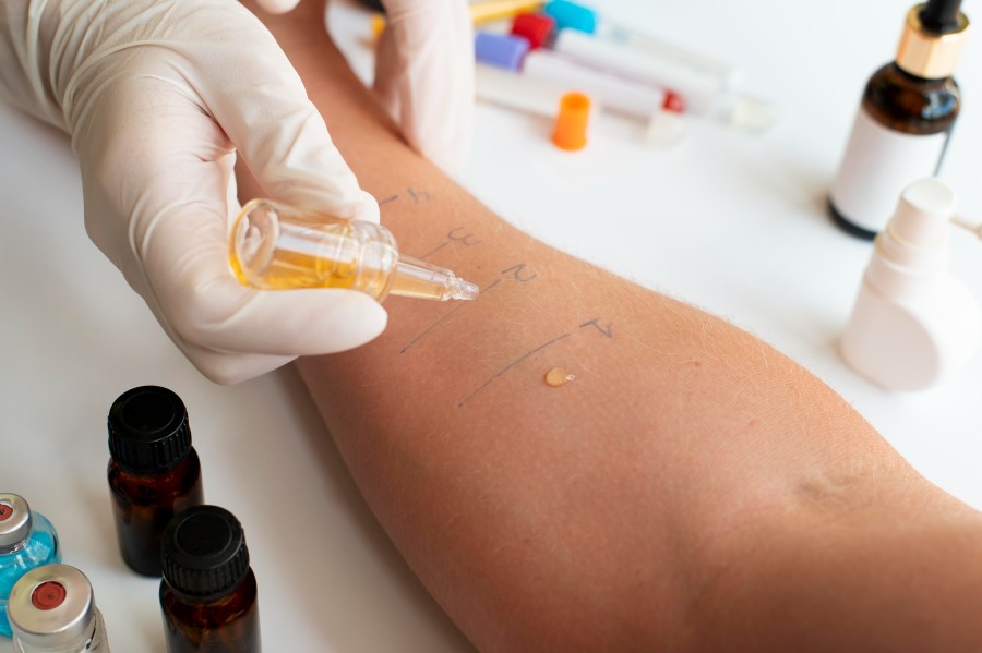 Skin Allergy Treatment