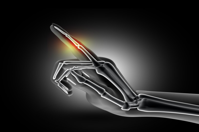Joint Pain