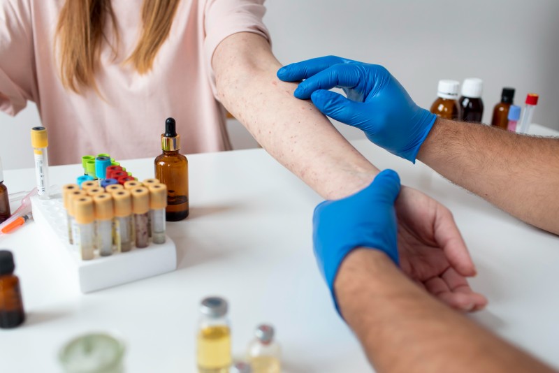 Food Allergy Testing